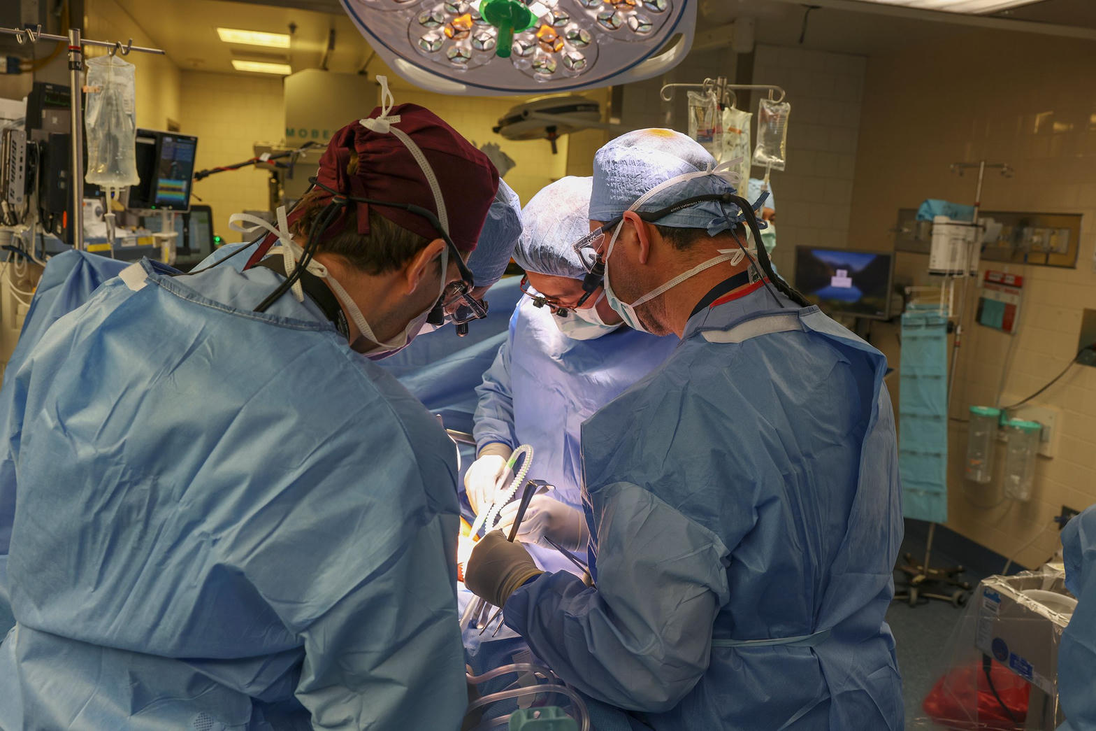 Surgeons in blue gowns and caps working under operating-room lights.